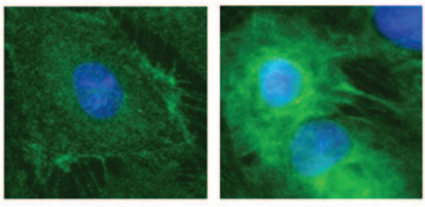 ECFCs under immunofluorescence — endothelial markers in green, nuclei in blue