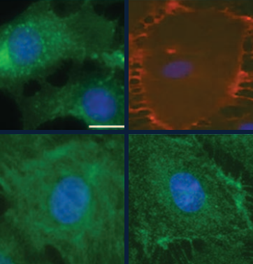 Immunofluorescence micrographs of placental ECFCs showing endothelial markers and tube formation